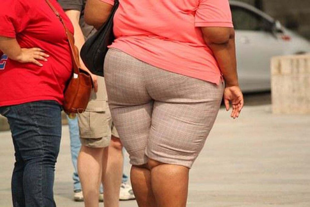 How Stress Causes Weight Gain