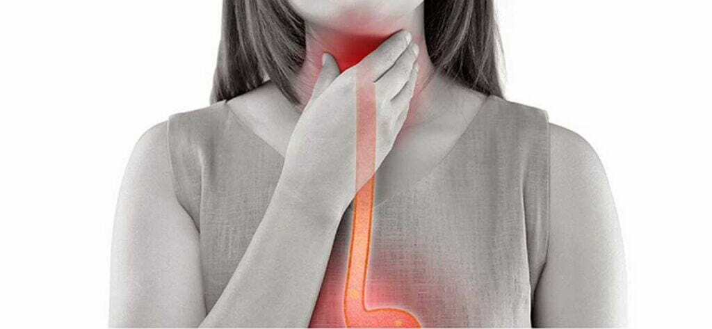 what is endometriosis