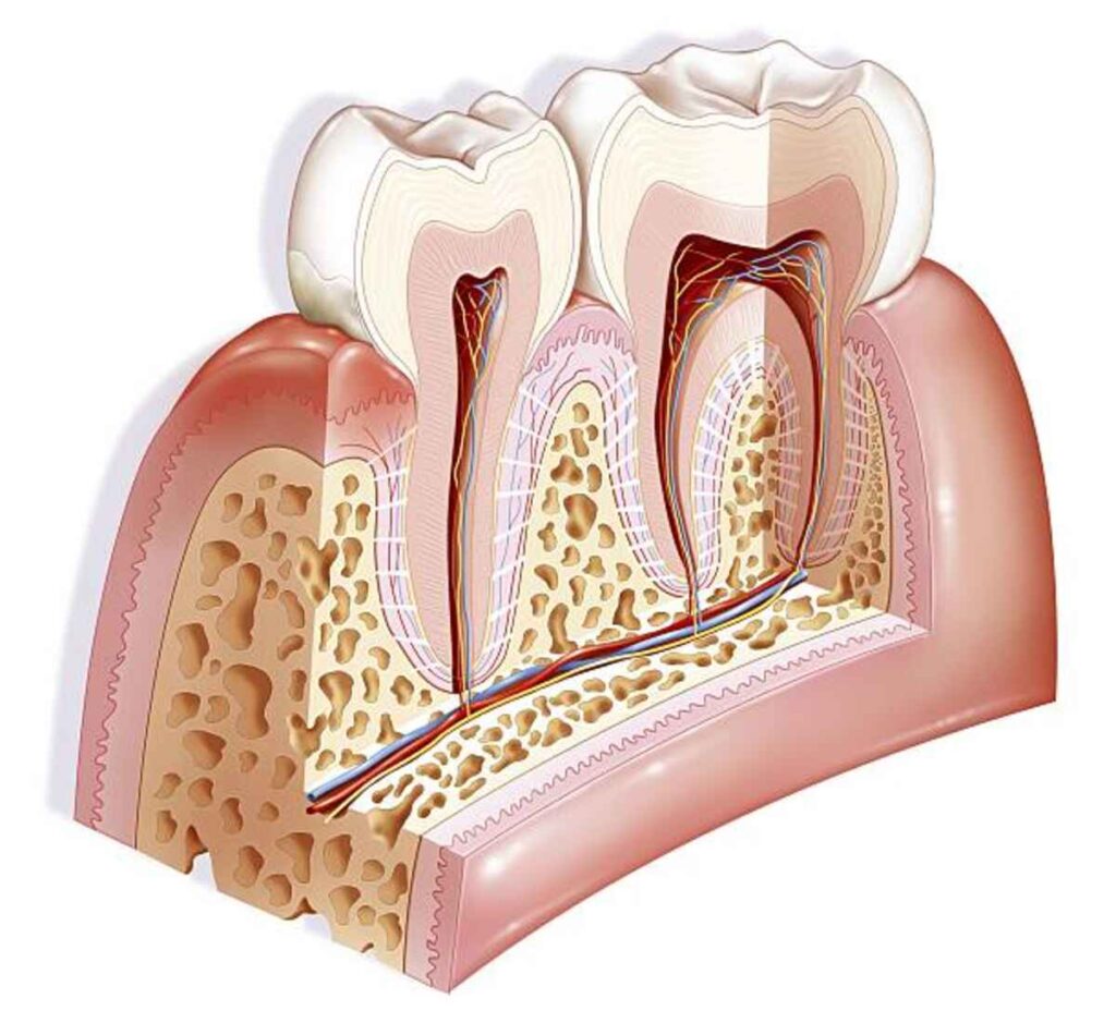 gingivitis
