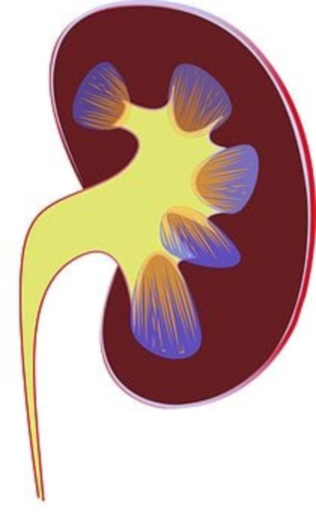 kidney infection